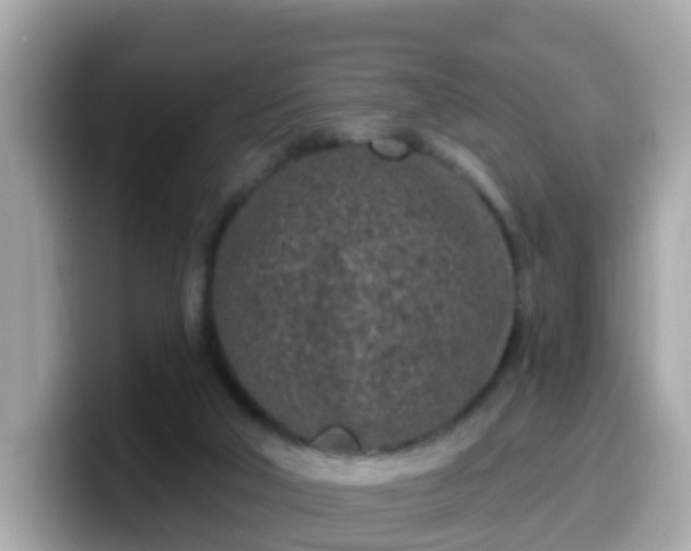 X0000099560018200805231521