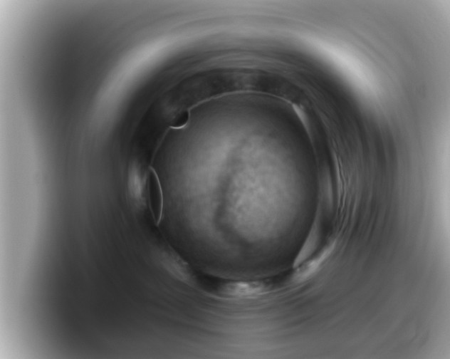 X0000099560239200805231518