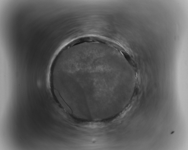 X0000099560292200805231517