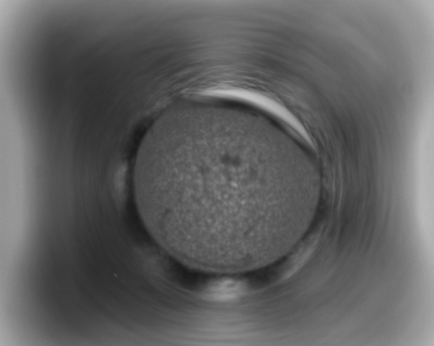 X0000099560319200805231517