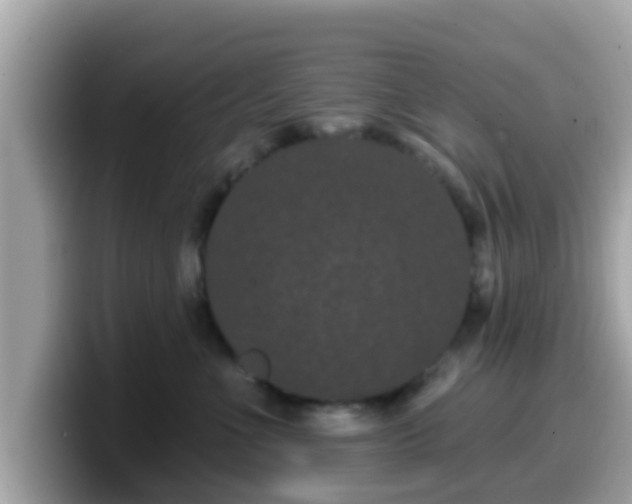 X0000099560523200805231515