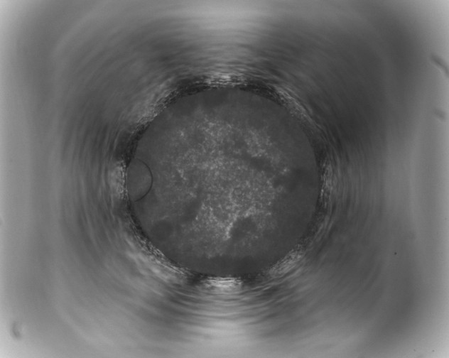 X0000099560659200805301542