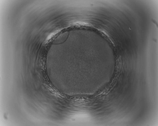 X0000099560919200805301538