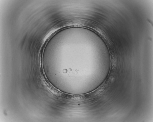 X0000099561078200805301536