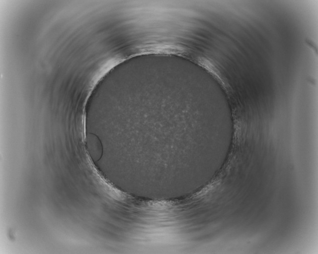 X0000099561079200805301536