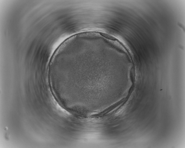 X0000099561102200805301536