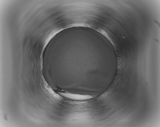 X0000099561140200805301536