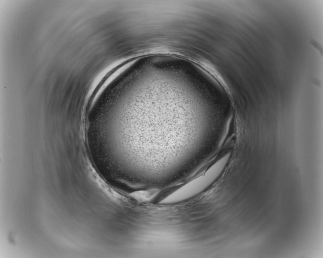 X0000099561148200805301536