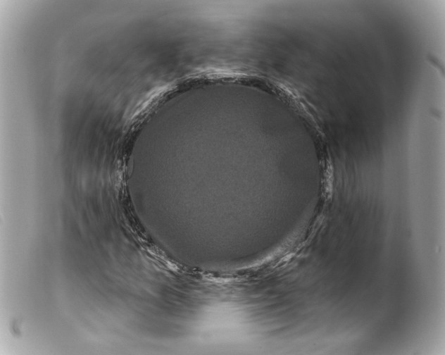 X0000099561157200805301535