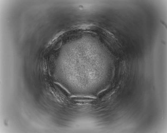 X0000099561158200805301535