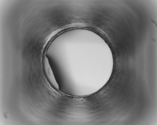 X0000099561168200805301535