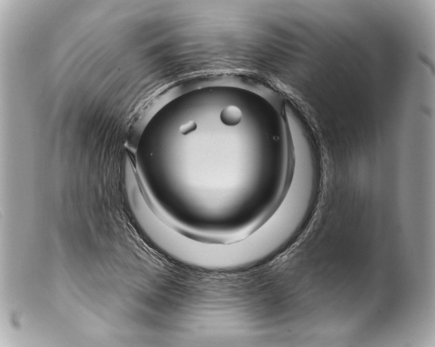 X0000099561169200805301535