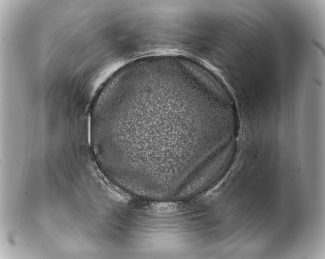 X0000099561171200805301535