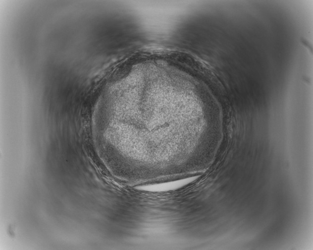 X0000099561397200805301532