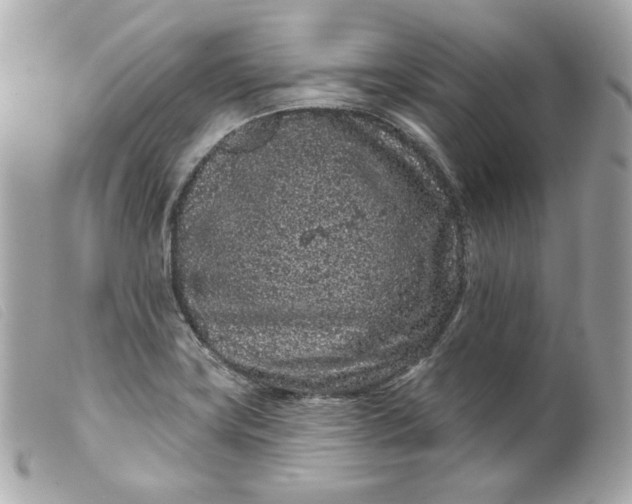 X0000099561419200805301532