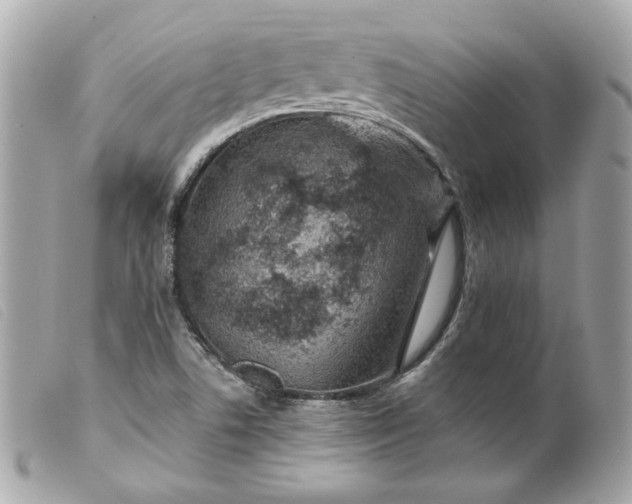 X0000099561506200805301530