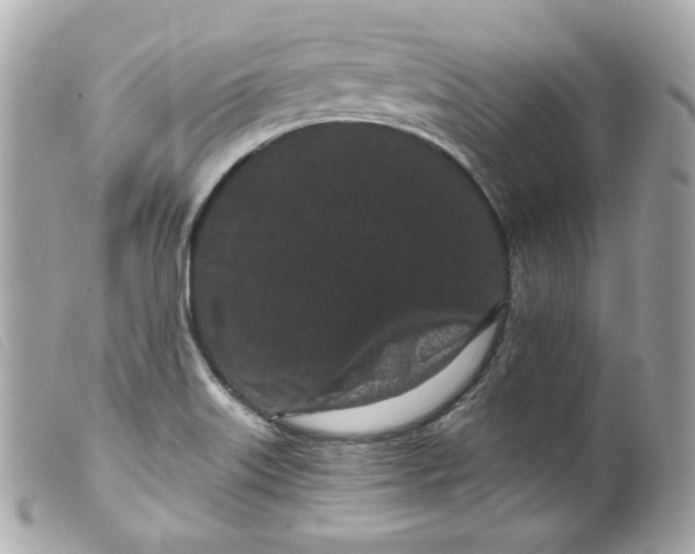 X0000099561515200805301530