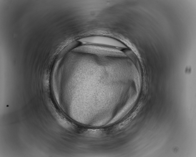 X0000099560057200806061549