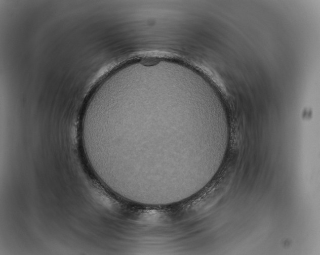 X0000099560111200806061548