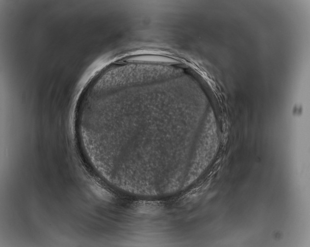 X0000099560296200806061546