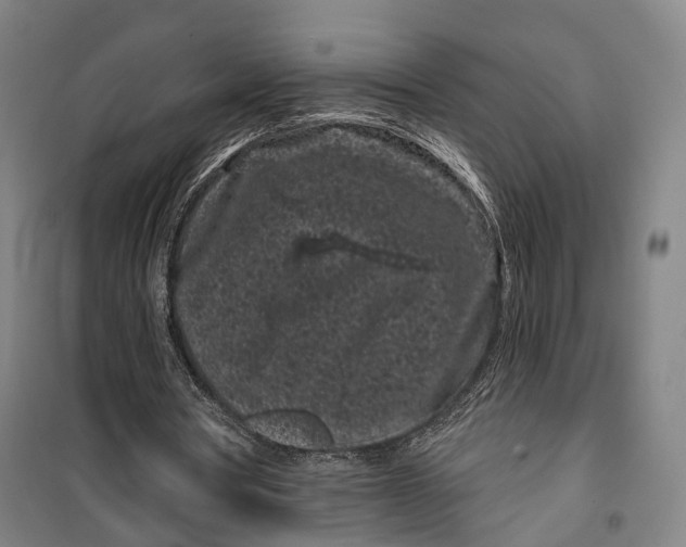 X0000099560386200806061545