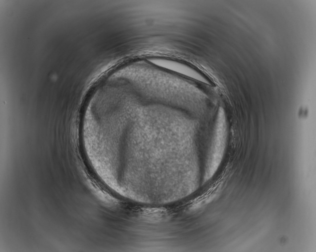 X0000099560446200806061543