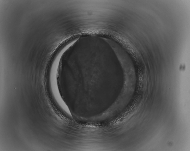 X0000099560592200806061541