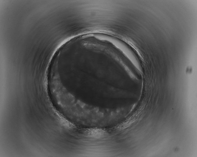 X0000099561024200806061535