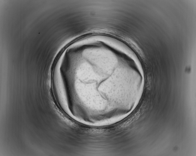 X0000099561036200806061535