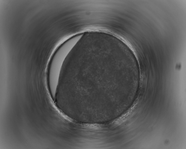 X0000099561045200806061535