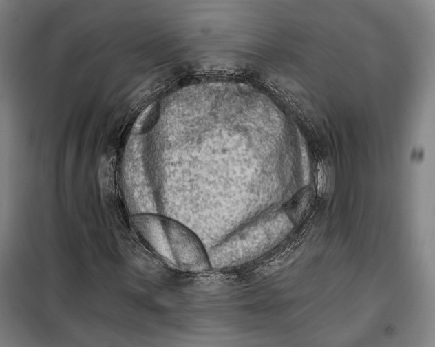 X0000099561059200806061535