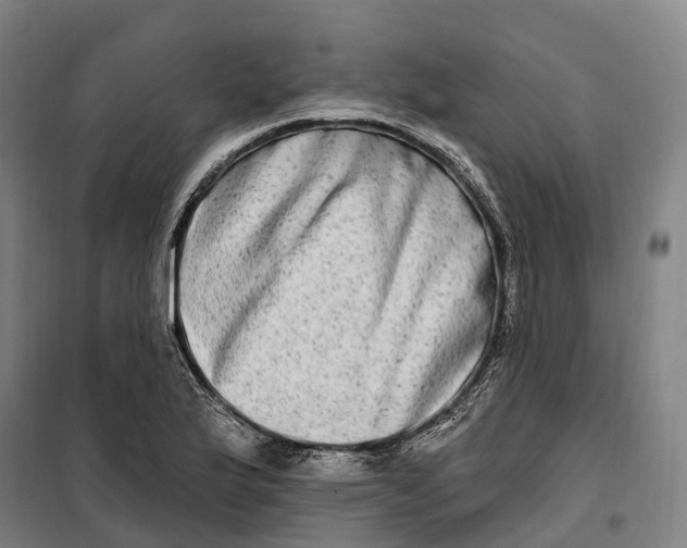 X0000099561175200806061533