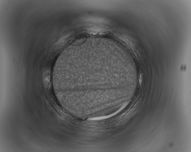 X0000099561396200806061529