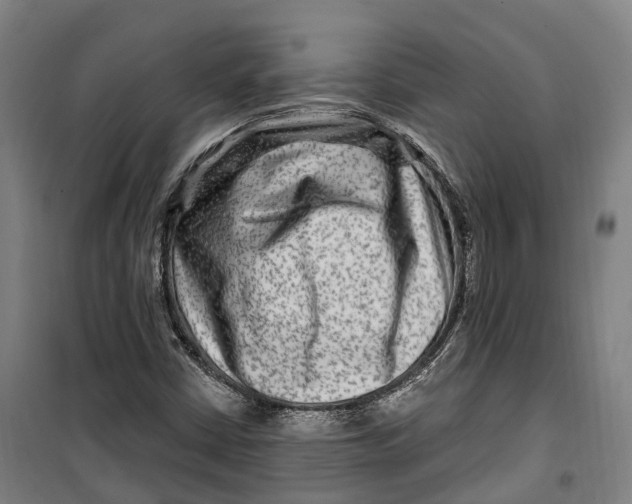 X0000099561402200806061529