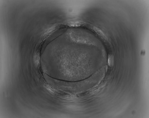 X0000099561444200806061529