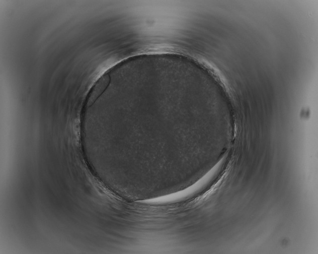 X0000099561457200806061529