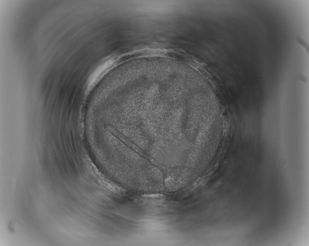 X0000099560053200806131243