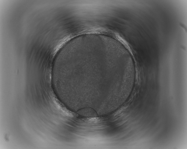 X0000099560059200806131243