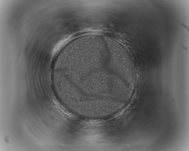 X0000099560149200806131242