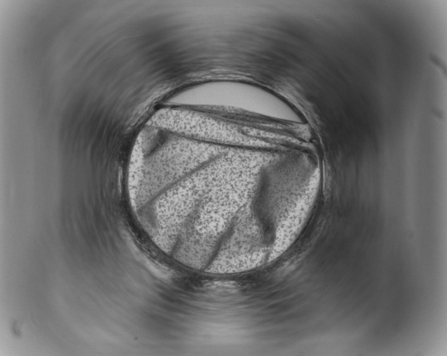 X0000099560157200806131242
