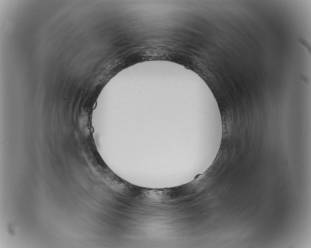 X0000099560187200806131242