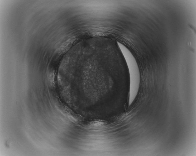 X0000099560219200806131241