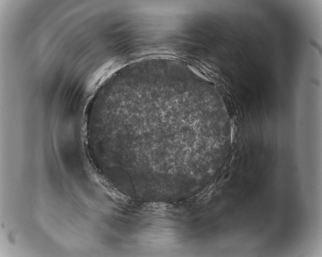 X0000099560339200806131239