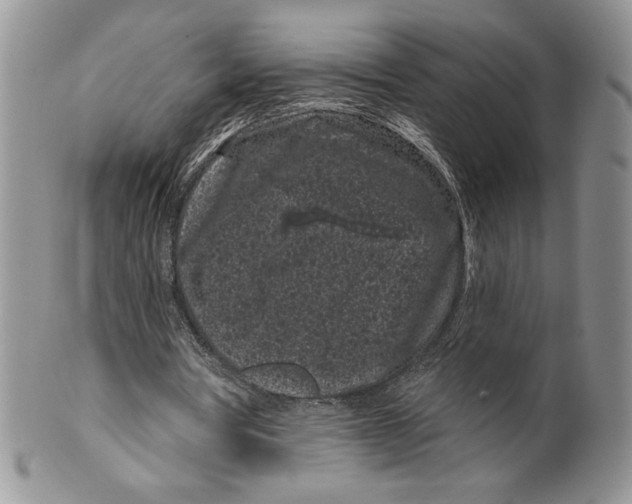 X0000099560386200806131239