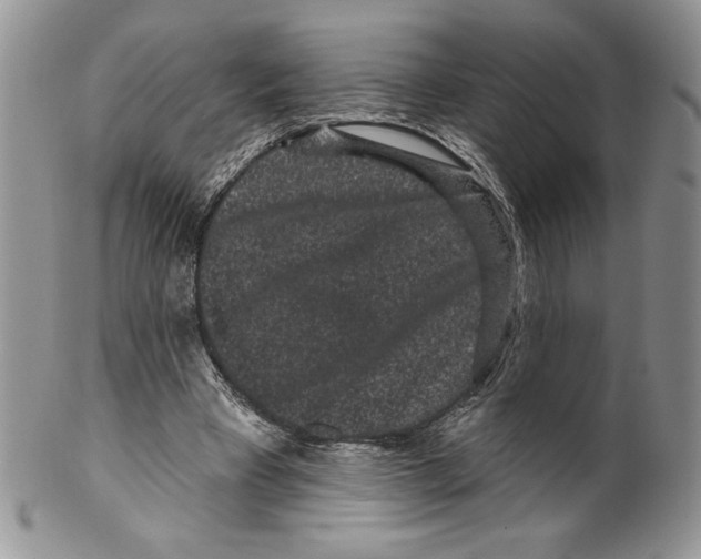 X0000099560393200806131239