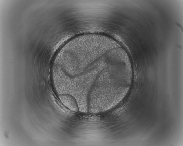 X0000099560443200806131237