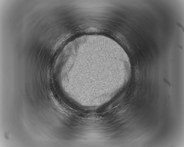 X0000099560491200806131237