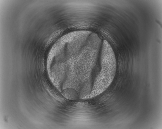 X0000099560494200806131237