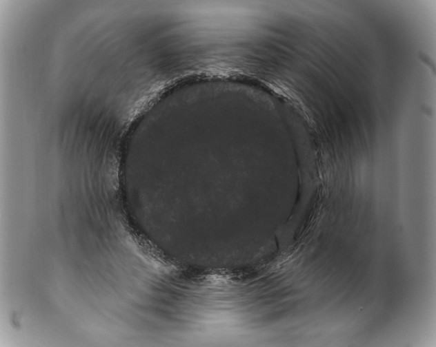 X0000099560496200806131237