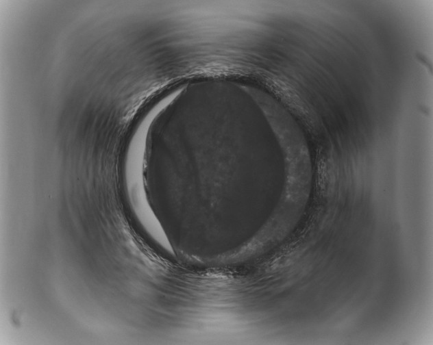 X0000099560592200806131236
